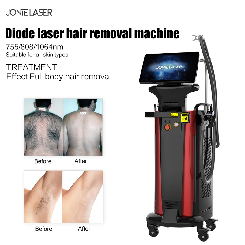 2 In 1 808 Diode Laser Hair Removal 755Nm 808Nm 1064Nm Laser Hair Removal Machine