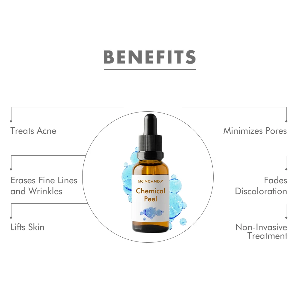 New Wholesale Hot Selling Skin Whitening Chemical Peel Facial Anti Aging Skin Care Face Serum With Bottles