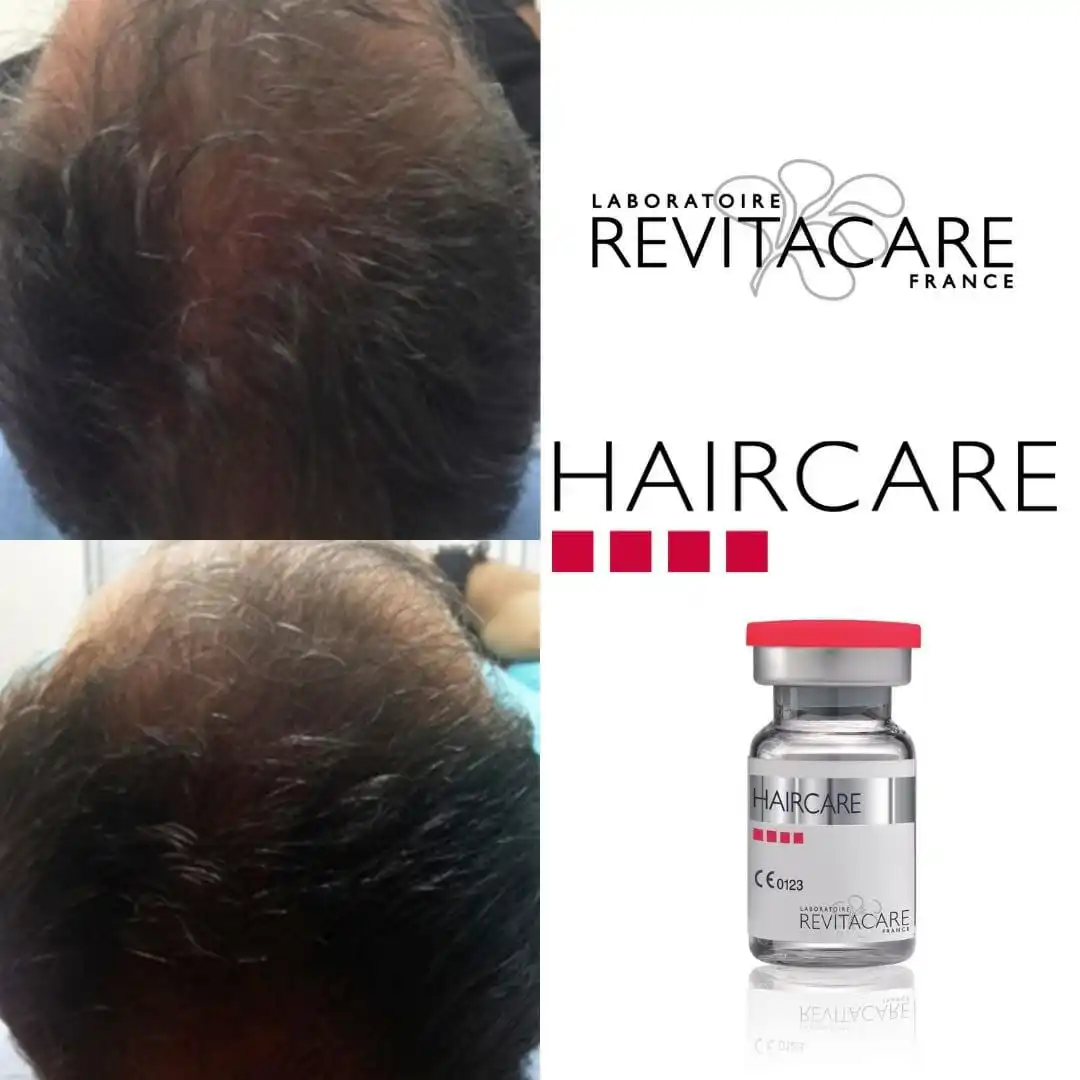 CYTOCARE Booster Hair Serum - Advanced Hair Thinning Serum for Density,  Hair Thickening Serum for Thicker and Fuller Growth