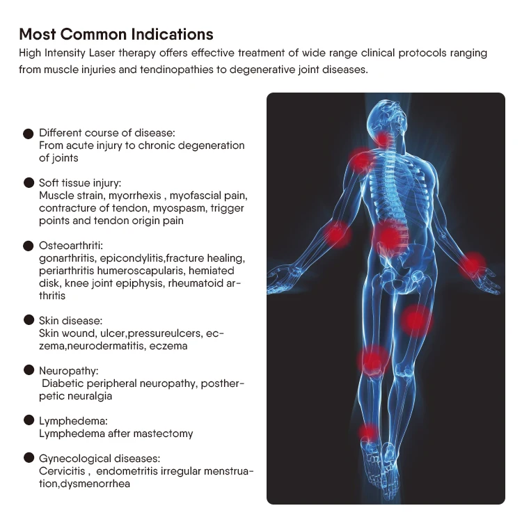 Advanced High-Intensity Class IV Laser Therapy 60W for Pain Management and Recovery in Farm Animals and Domestic Pets