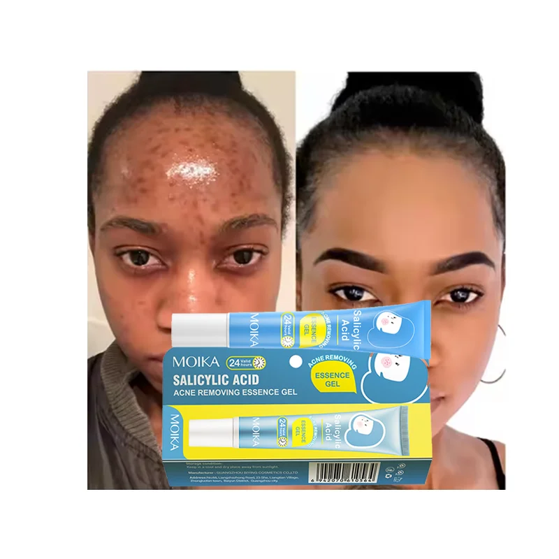 Clears Blemish Pimple Remover Spot Whitening Skin Treat Anti Acne Cream