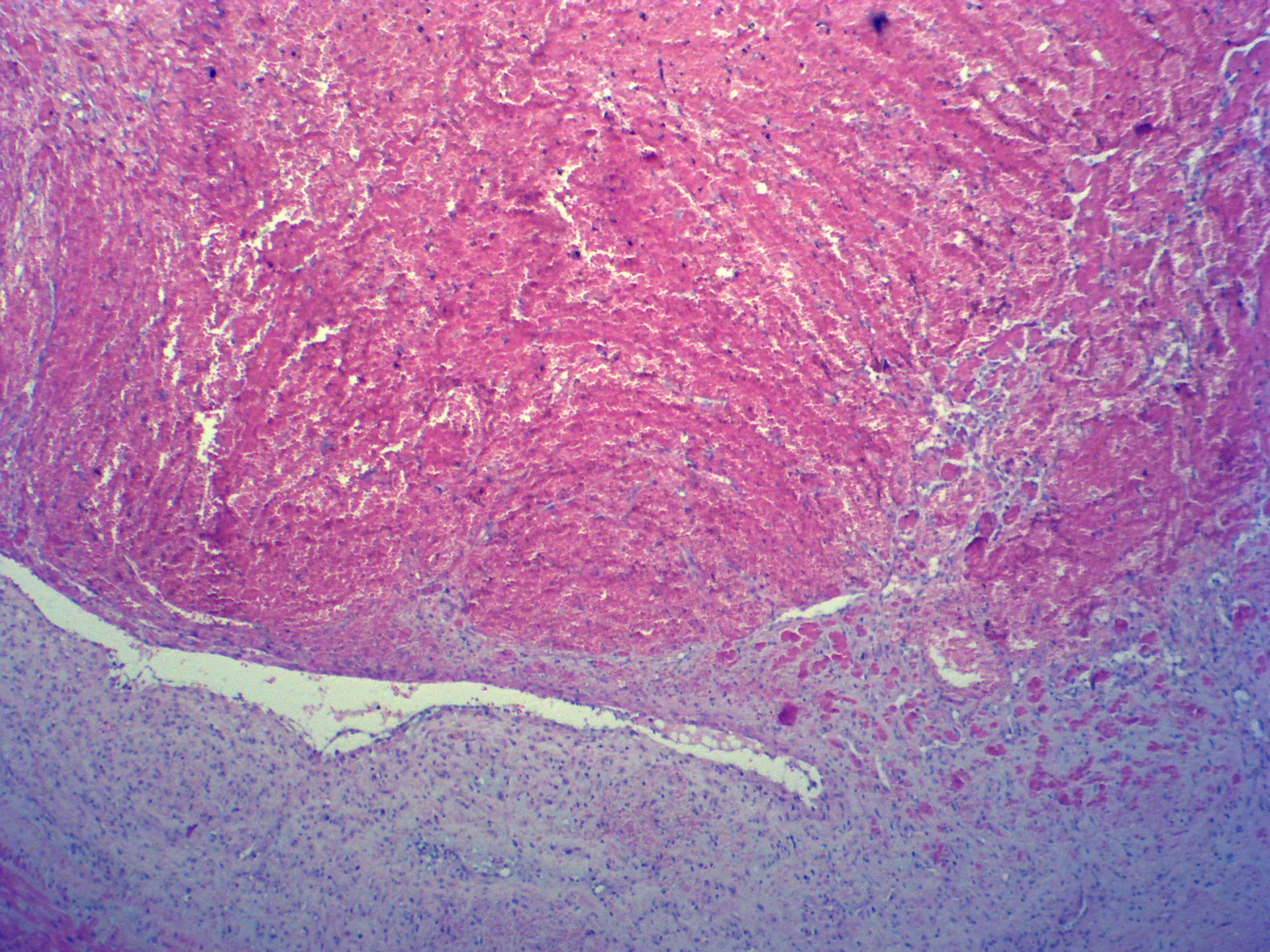 Medical biology laboratory human pathology preparation microscope slide specimen equipment