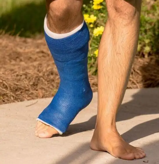 Short LEG Fiberglass Cast