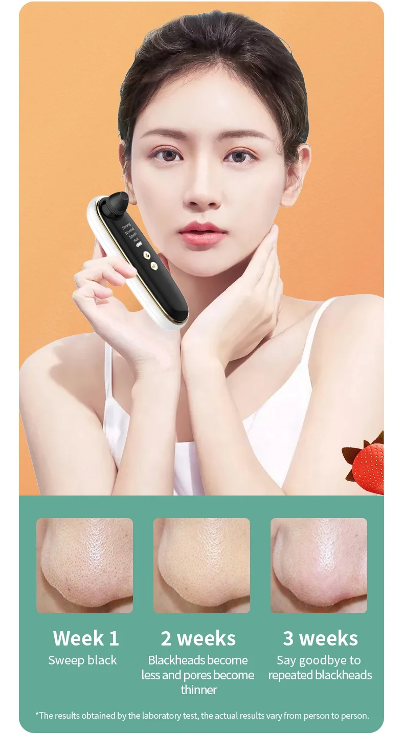 
Visual HD Vacuum Blackhead Removal Suction WIFI Visible Blackhead Remover with Camera 