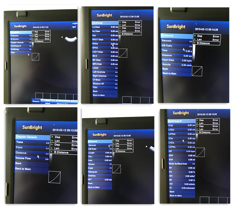 Portable Color Doppler Ultrasound Machine Price Medical Echocardiography with Phased Array Probe