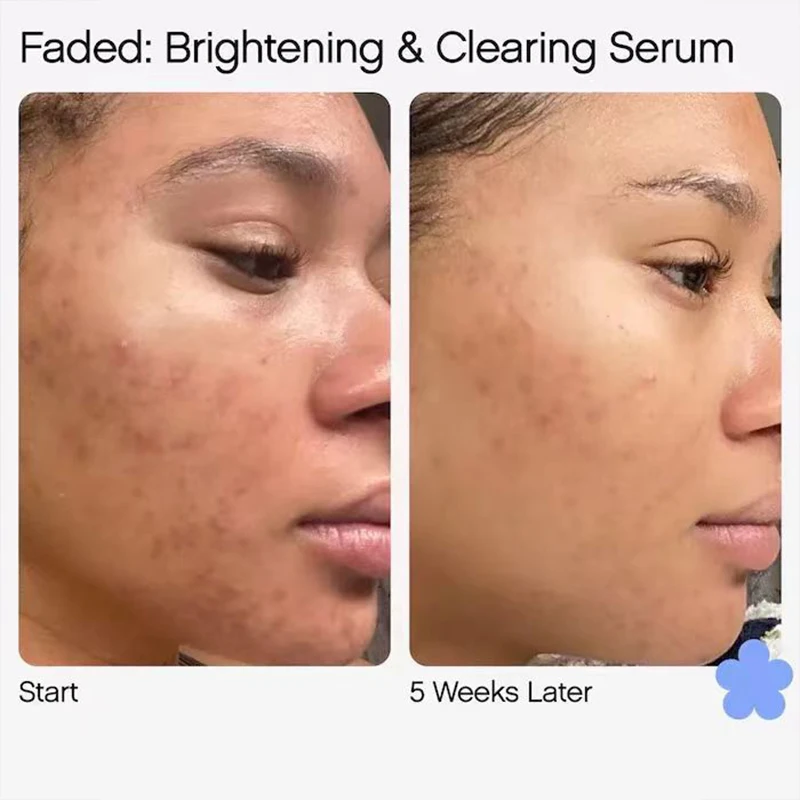 Topic Brightening Clearing Serum Mini Faded Skin Serum For Dark Spots Fadedd Scars Serum 0.5 Fl Oz Als