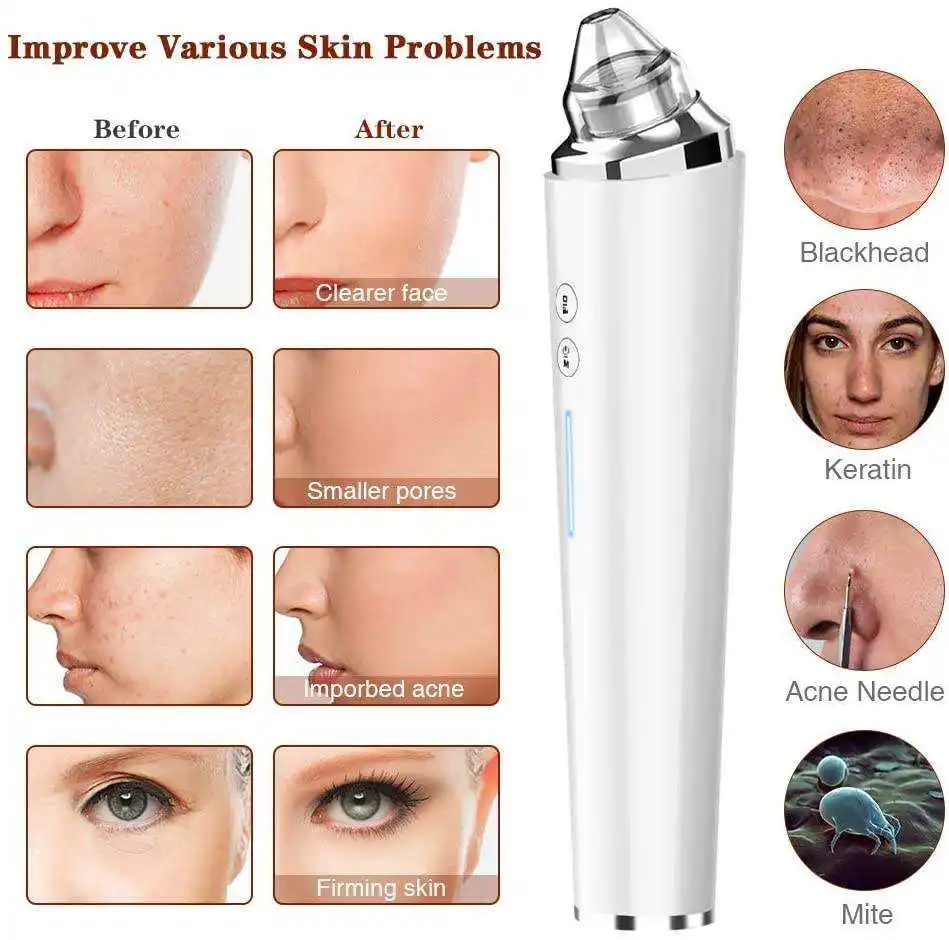 2024 New 6 Heads Electric Acne Blackhead Removal Tool Nose Pore Cleaner Blackhead Remover Vacuum