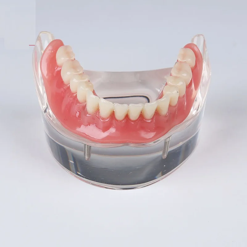 Модель стоматологической практики, обучающая тренировочная модель стоматологической имплантации