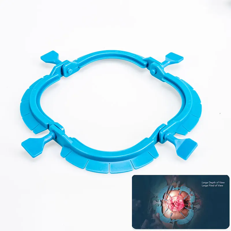 Medical Disposable Abdominal Surgical Retractor Rings C Series Self-Retaining Lone Star Retractor For Anorectal Surgical