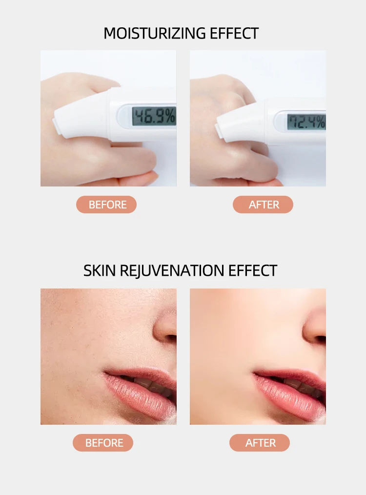 
Skin tightening 5 in 1 rf therapy device radio frequency facial machine portable for face led facial massager 