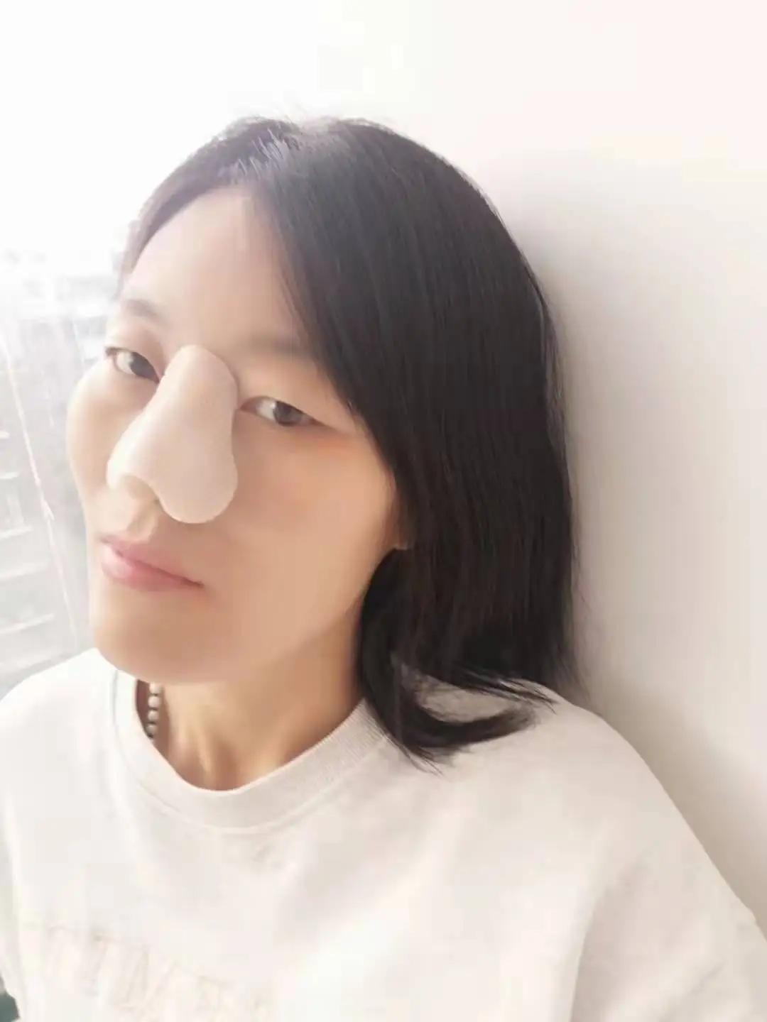 Orthopedic Thermoplastic Nose Cast External Nasal Splint after Plastic Surgery