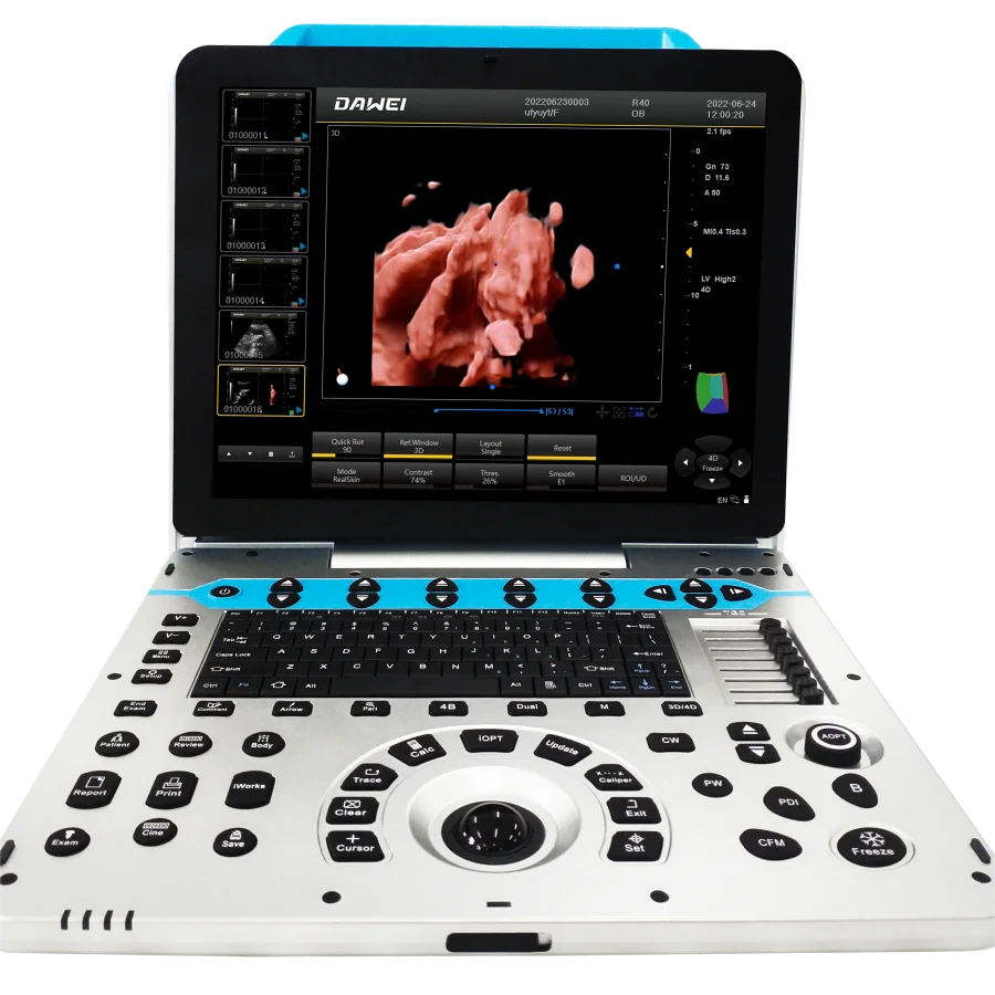 obstetrics and gynecology 3D ultrasound color doppler for pregnancy