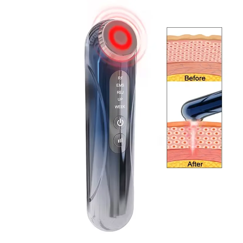 Hot Sale Domestic Beauty Lift Facial Skin Tightening Massager Anti-Aging Firming Frequency Wand Device for Home Use