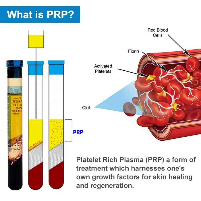 LONGTIME Factory Price Medical Platelet Rich Plasma PRP Tube for Endometritis