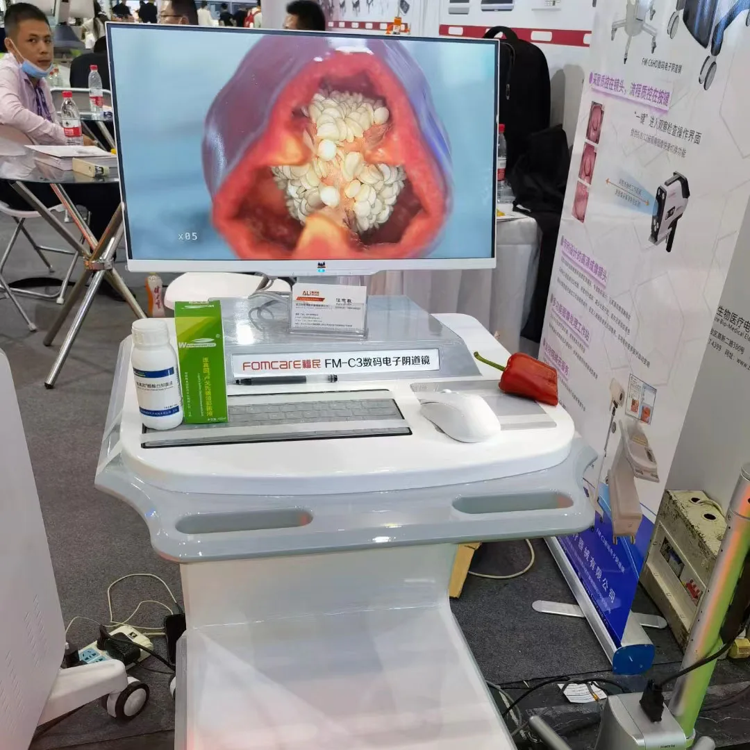 Good quality  C6HD vaginal colposcopy gynecological disease diagnostic instrument that can be customized