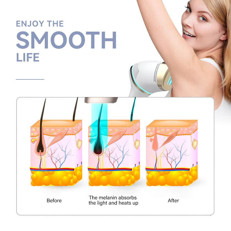 Cooling Painless Ipl Ice Cool Hair Removal Semiconductor Refrigeration Permanent Hair Remover Device