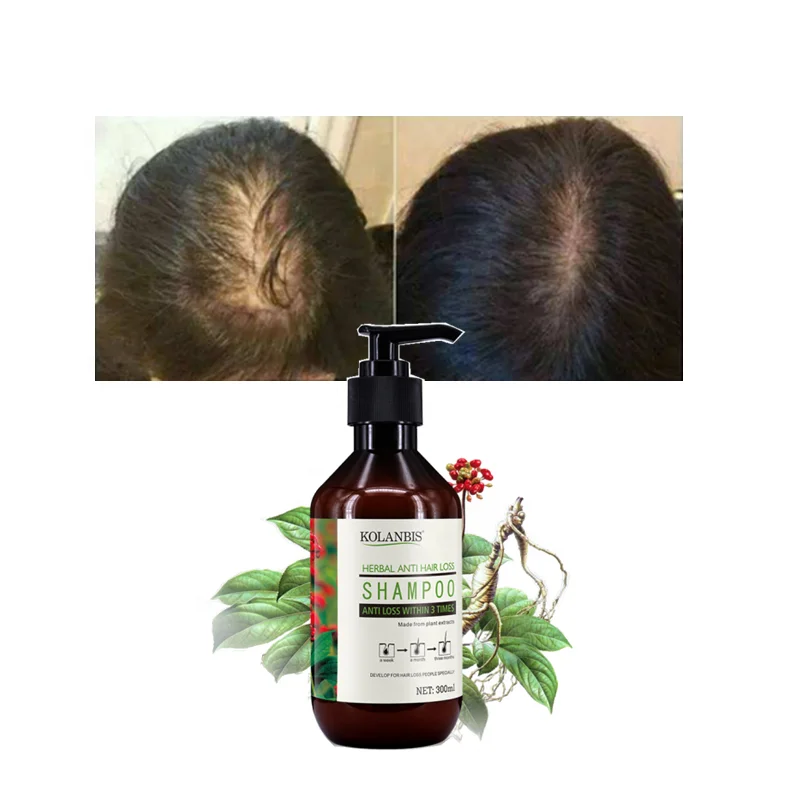 KOLANBIS Wholesale Organic Hair Growth Shampoo Panax Ginseng Fast Hair Regrowth Essence Anti Hair Loss Treatment