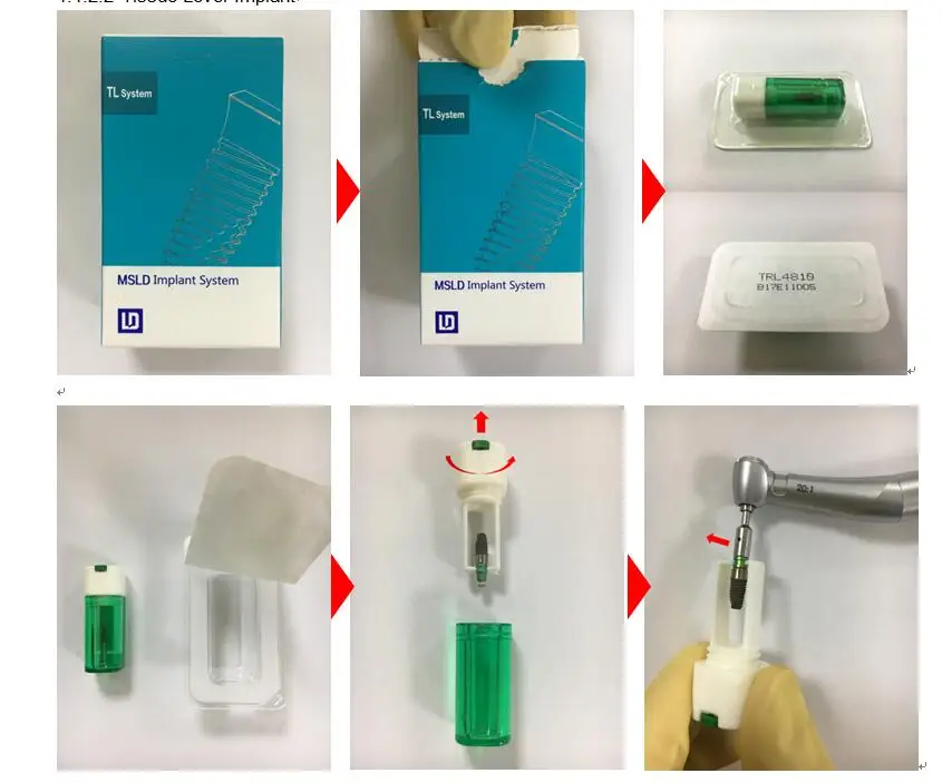Dental Implant Fixture And Screw And Abutment Implants & Interventional Materials