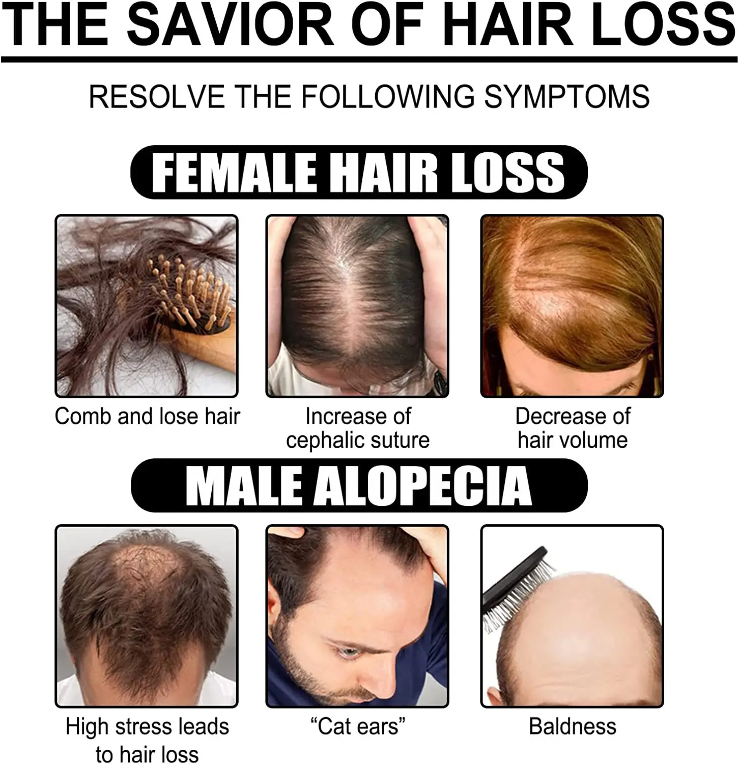 Anti Hair Loss Treatment Natural Ginger Root Melon Fast Hair Growth Serum Hair Growth Oil Serum for Men and Women