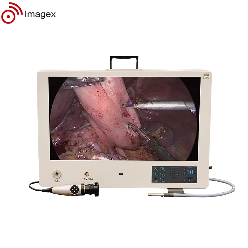 2K 4K Compact integrated Endoscopy camera system for endoscopic surgery