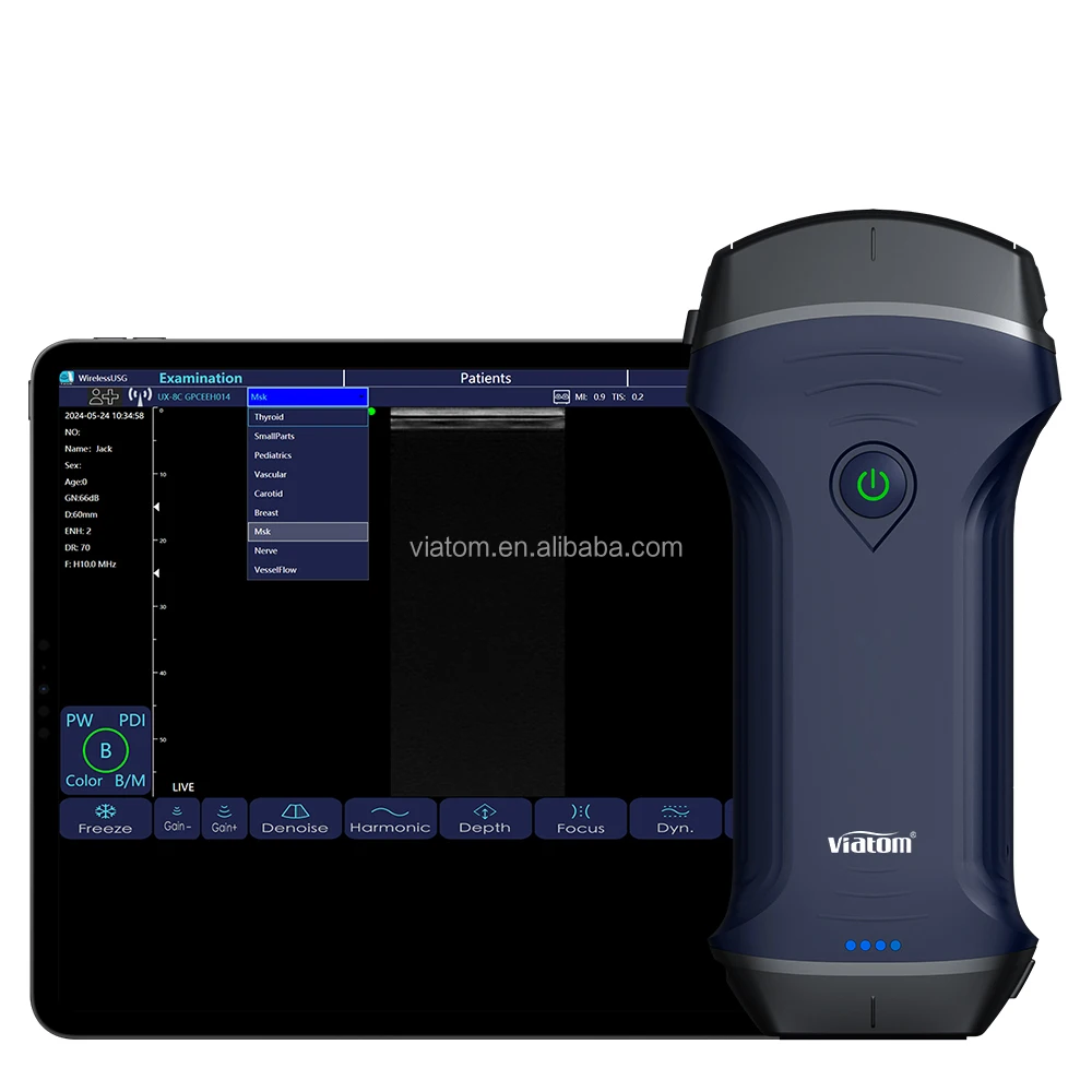 Viatom Wireless Ultrasound Scanner Portable Cooling Coating Technology Convex Cardiac Linear Medical Handheld Ultrasound Probe