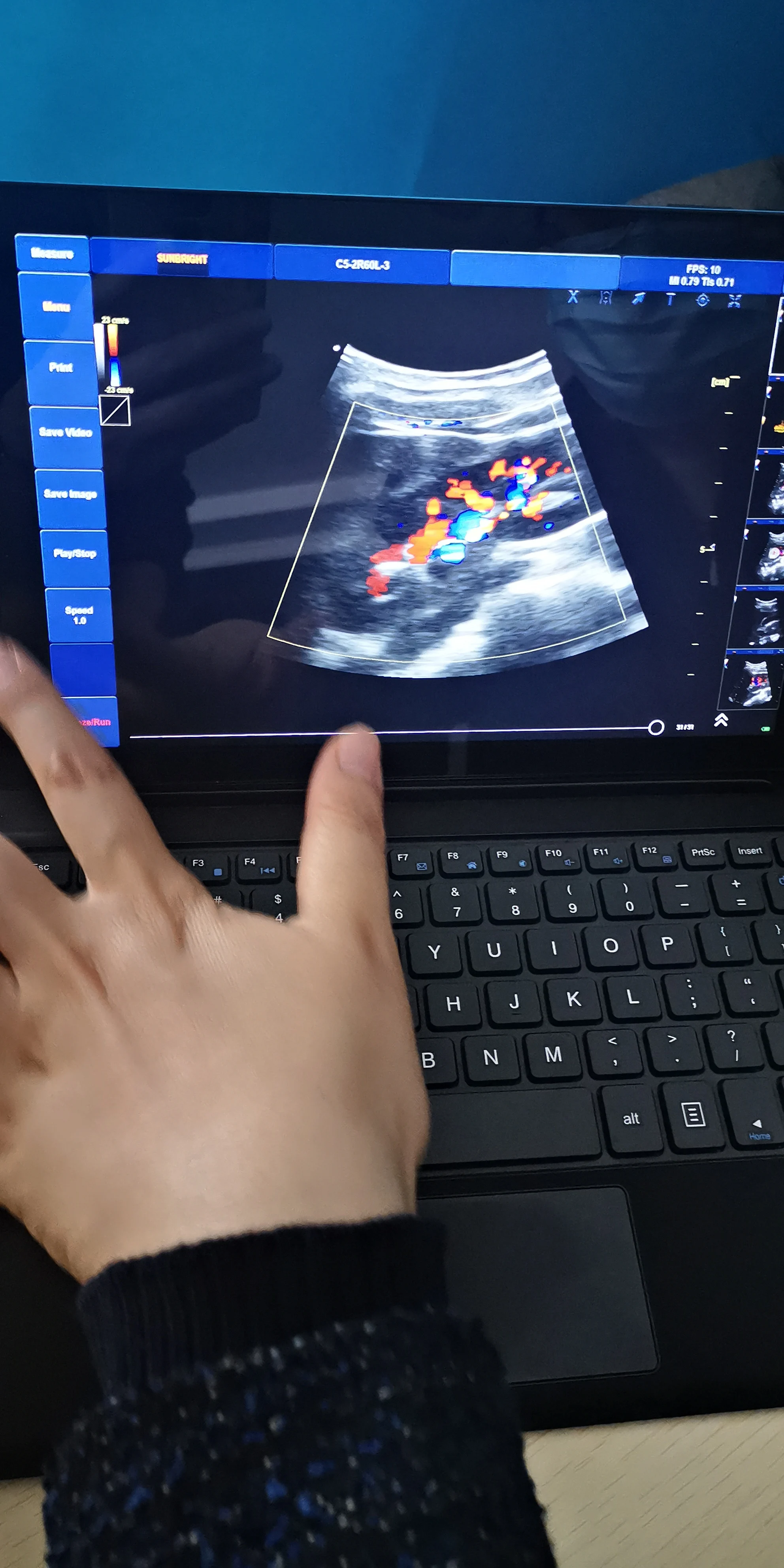 hospital ultrasound vaginal transducer USB Doppler probe device