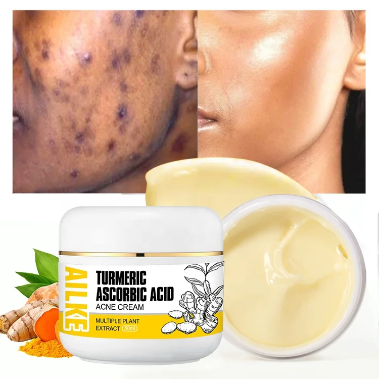 AILKE Dark Spot Acne Marks Removal Smoothing Face Pimples Vitamin C Lightening Facial Acne Cream For Black Skin
