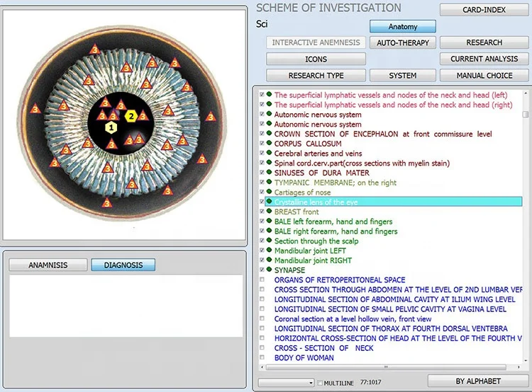 Новинка 2022, терапия Aura, NLS биорезонансное акупунктурное устройство iris aura DNA РНК 12d nls, диагностическое устройство