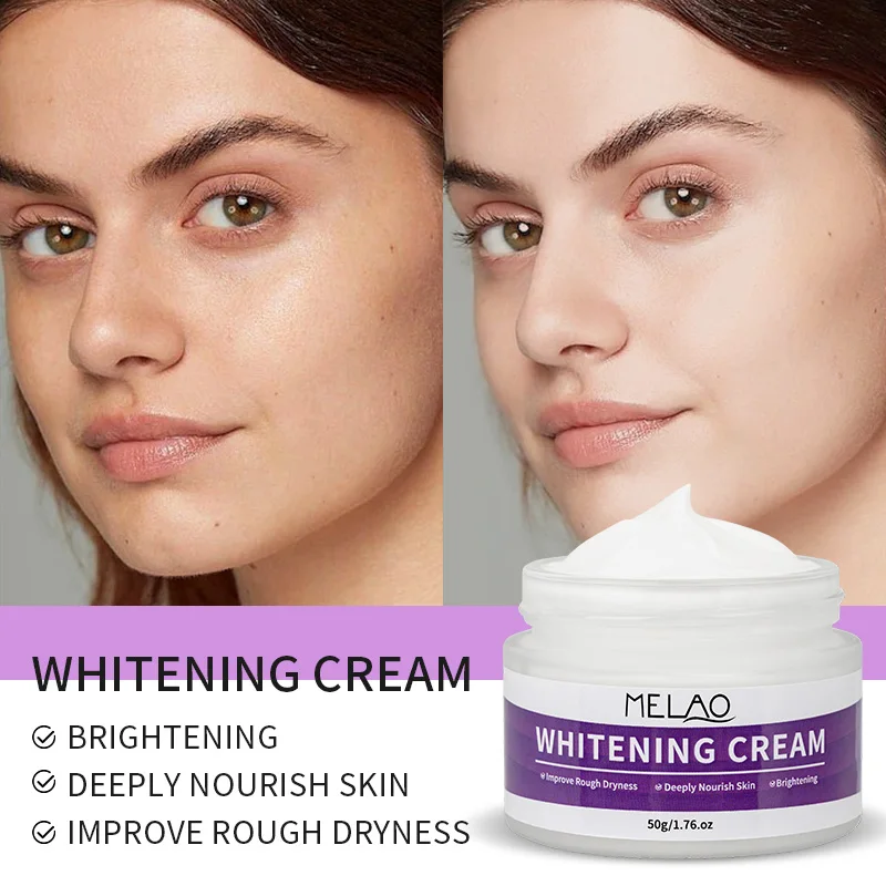 luxury lady Whitening Face Care NIACINAMIDE cream Skin Facial Cream
