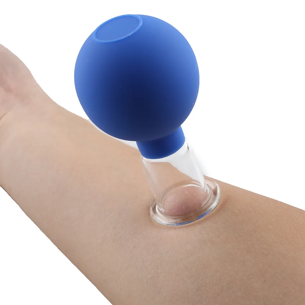 Cupping4.jpg