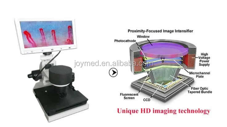 JOYMED JM-1004C Noninvasive capillaroscope nail bed capillaroscopy test system with analysis software