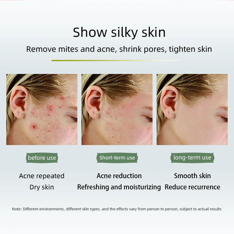 Handmade Rose Lily Moisturizing Handmade Soap Deep Cleansing Rose Soap Toilet Soap Face Whitening  Natural Scent Palm Oil