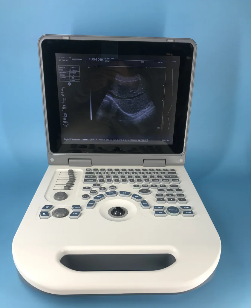Hospital used Medical Equipment Portable veterinary animal ultrasound device