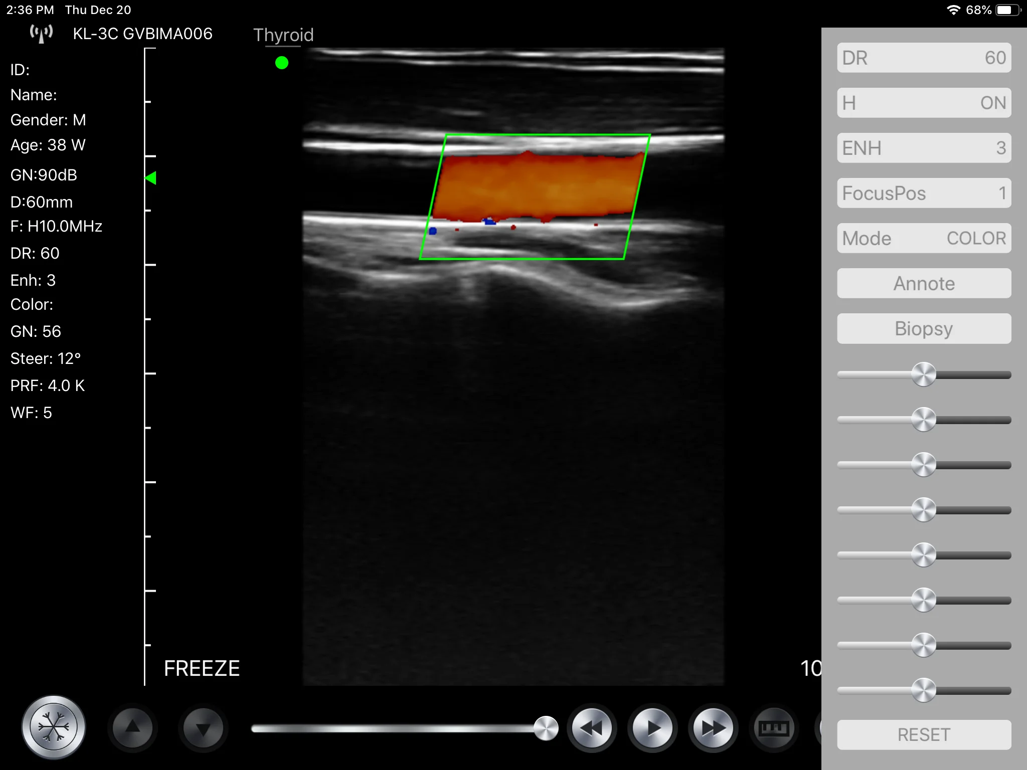 
huawei p20 pro Mini ultrasound color doppler portable ultrasound for pregnancy 