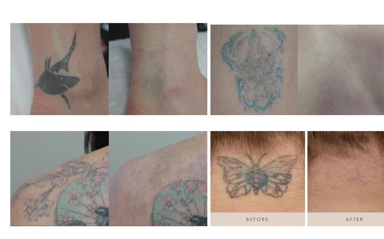 before and after750-3.jpg