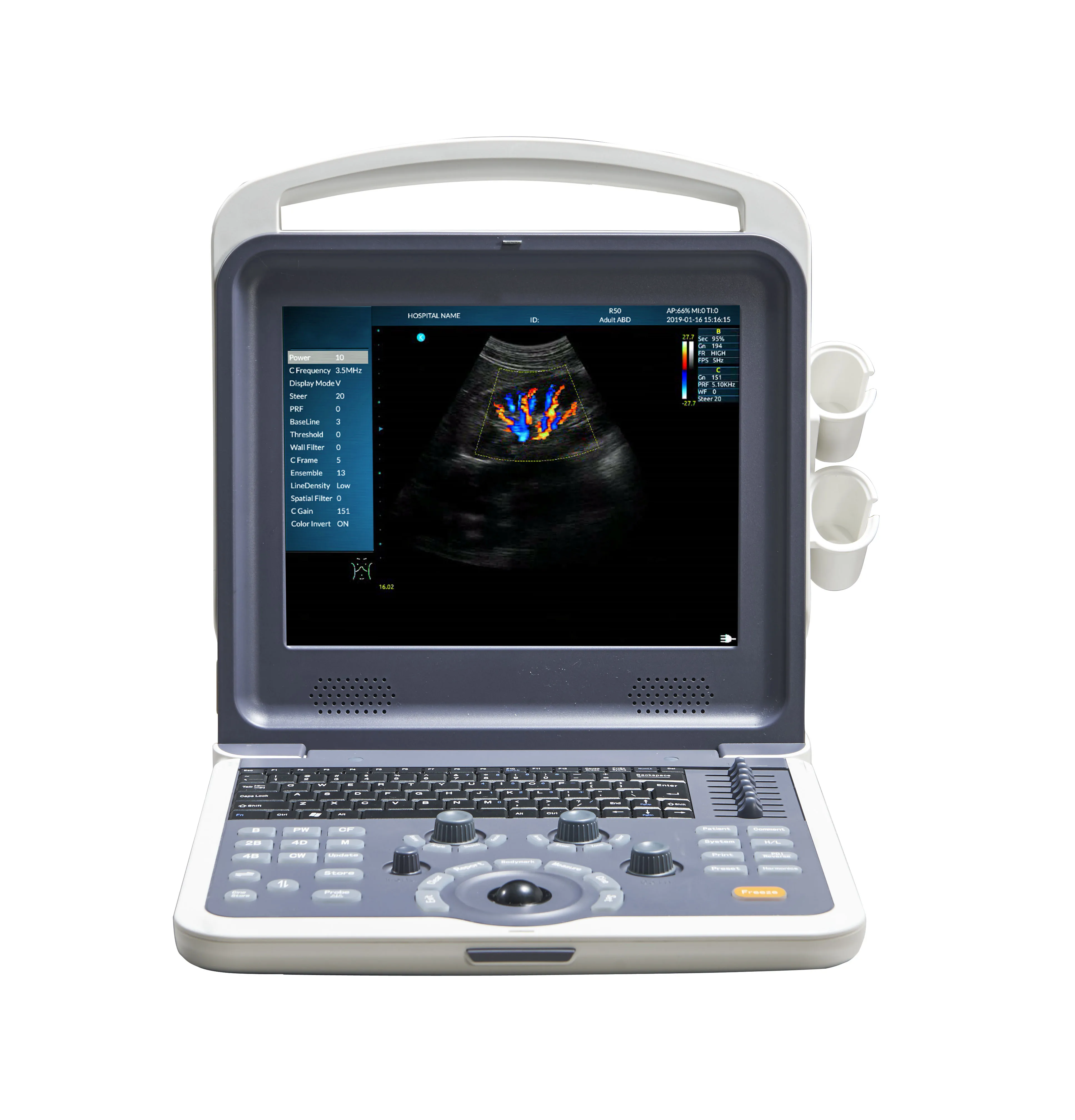 Portable Full Digital Laptop Color Doppler Ultrasonic Diagnostic System Ultrasound Scanner MSLCU62