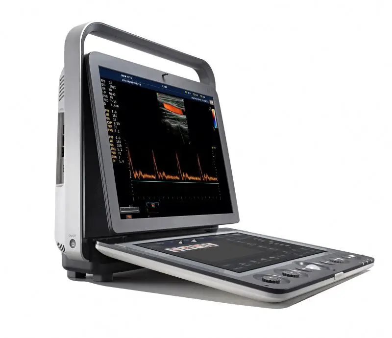 Portable Ultrasound Scanner Medical Instruments Medical Equipment Color Doppler S9 3D 4D Color Doppler Ultrasound Machine