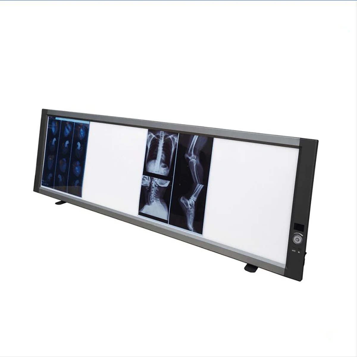 
China Quadruple Panel Medical LED X-ray Film Viewer X-ray Viewing Light MSLZG4C 