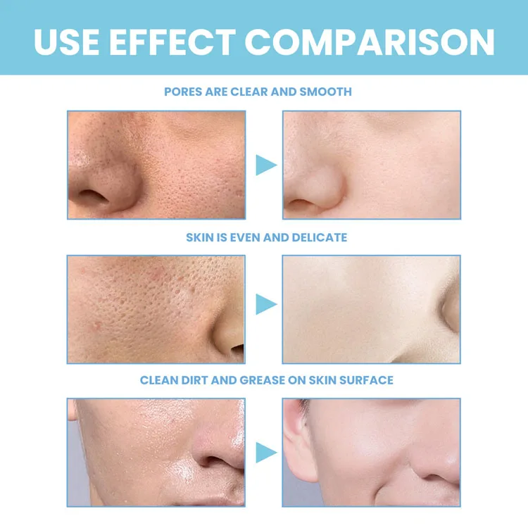 Wholesale Private Label Deep Clean Anti-Acne Gentle Remove Oily face wash facial cleanser for All Skin