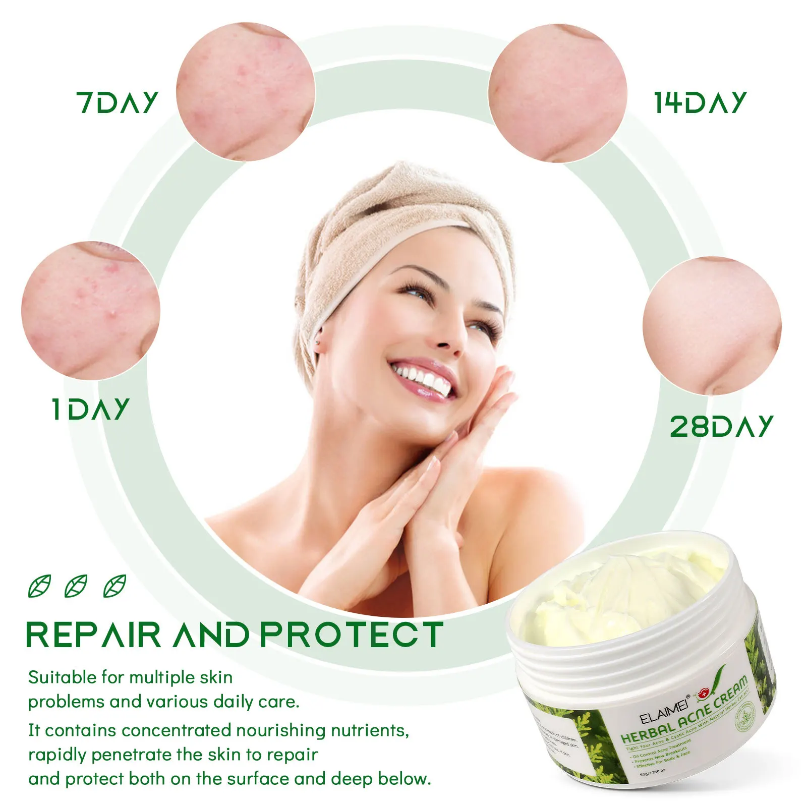 Private Label Natural Herbal Acne Repair Cream Beauty Effective For Face Body Oil Control Acne Treatment Cream