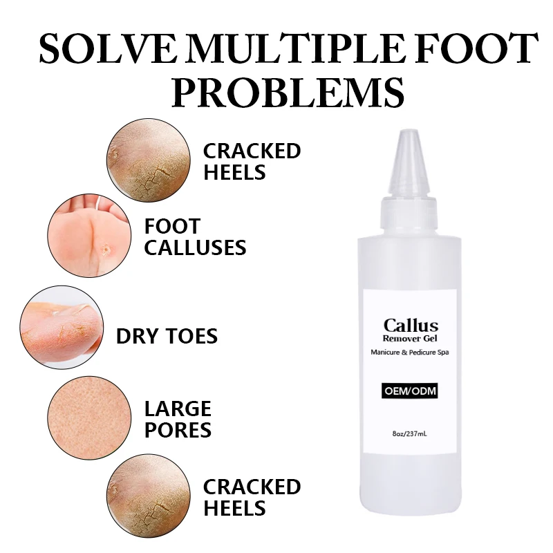 Customized Factory Price Extra Strength Foot Exfoliator Gel Remueve Callos Salon Grade Home Pedicure Supplies Callus Remover Gel