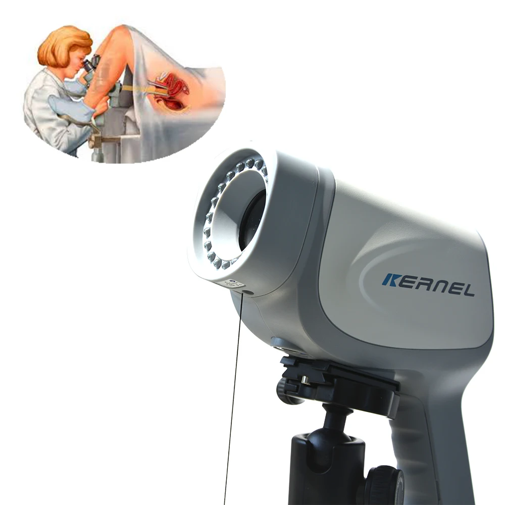 Medical CE Gynecological Examination 2100000 Pixels Colposcopy Machine System Digital Video Colposcope for Gynecology