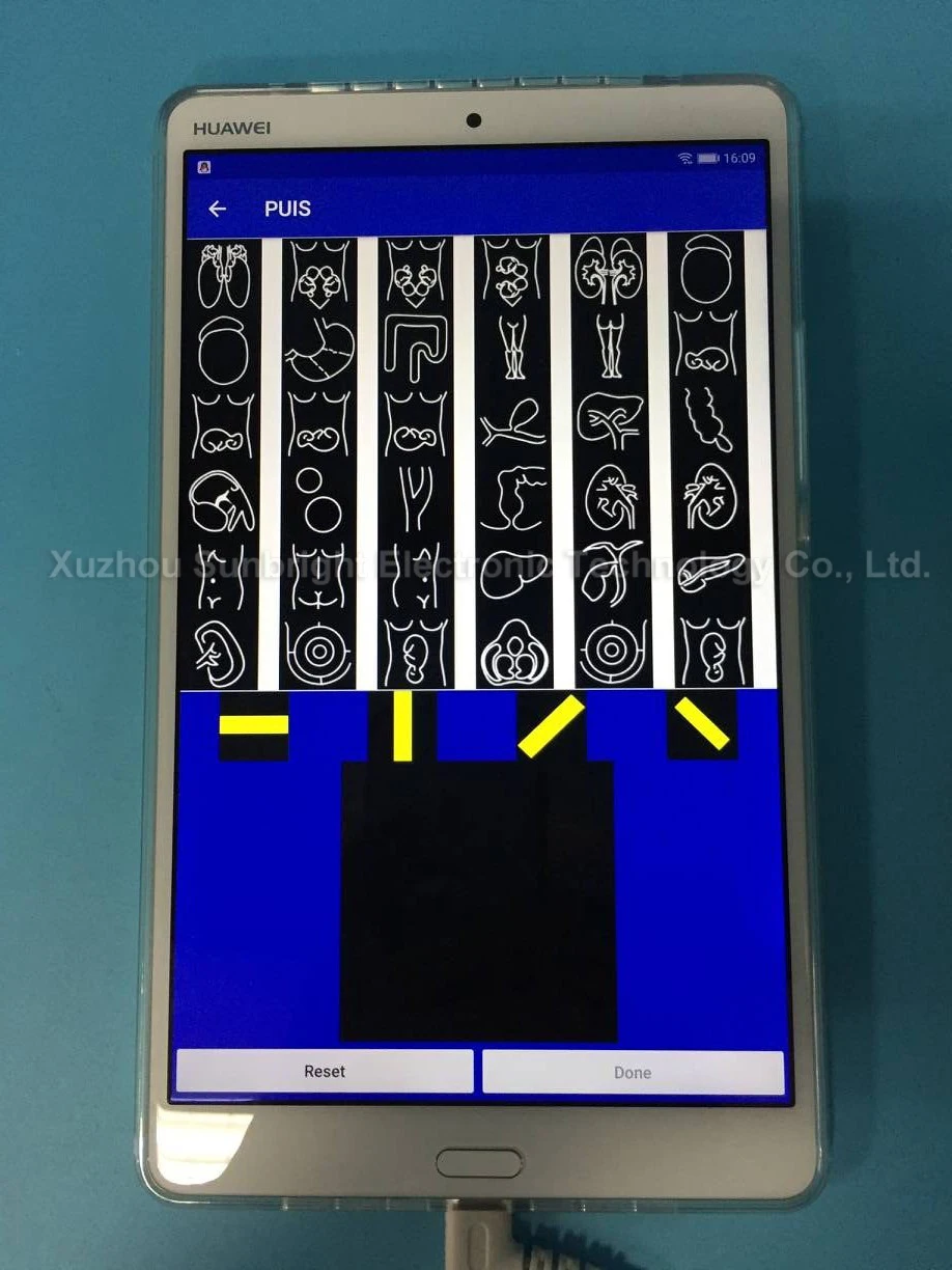Wifi ultrasound USG wireless ultrasound probe type C connector IOS android mobile device
