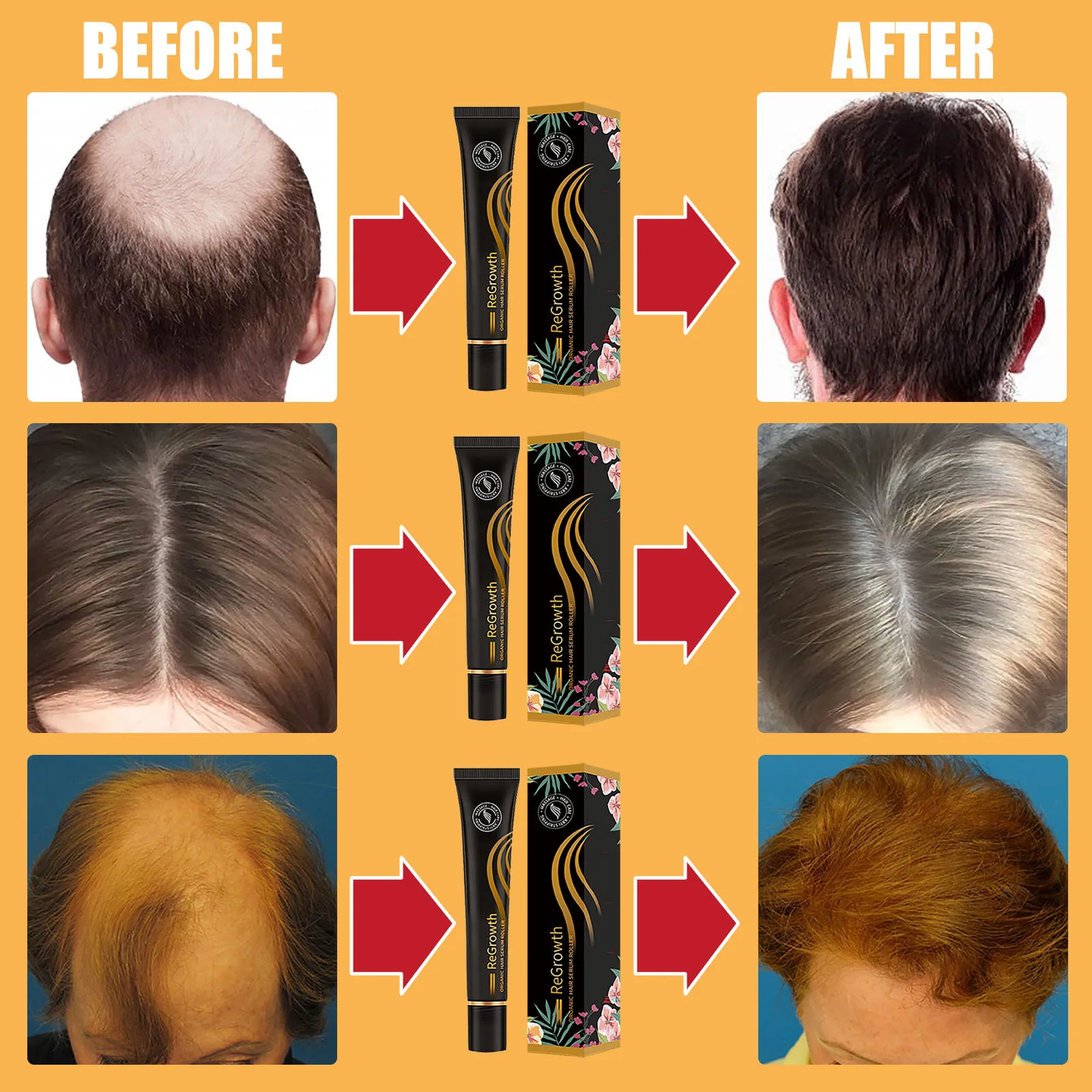 Natural Essence For Hair Growth Oil Scalp Massage Treatments Hair Loss Remedy Ginger Grow Hair Products Care For Women Men