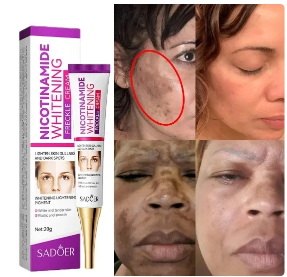 Whitening Cream Repairing Freckle Pigmentation Improving Dark Yellow Smoke Amide Reducing Melasma Facial Whitening Cream