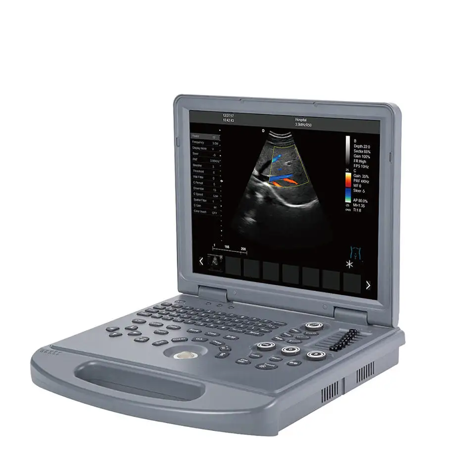 Veterinary Laptop Medical Ultrasound Scanner Color Doppler Ultrasound Machine for Animal Vet