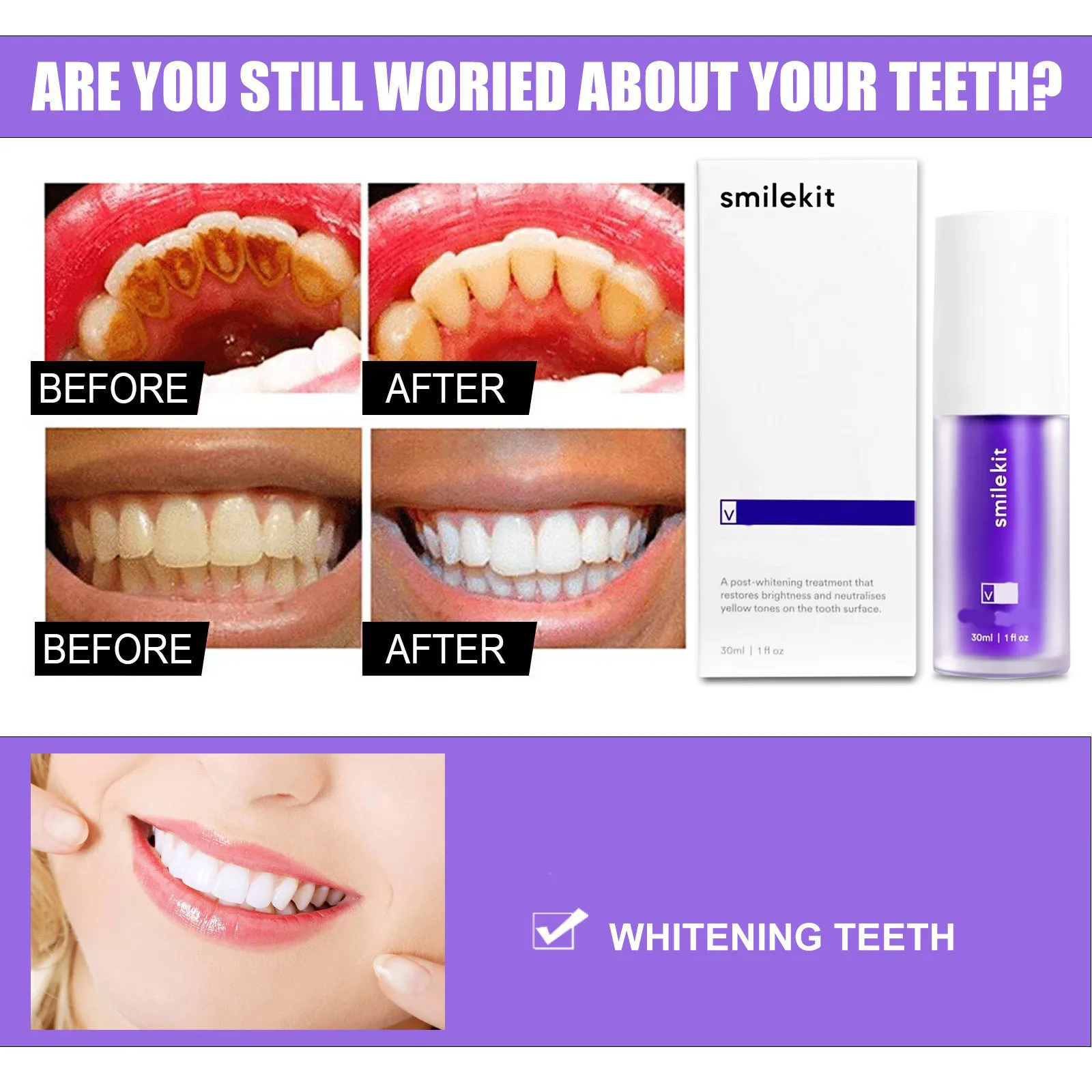 smilekit purple color toothpaste 30ml Purple Color Serum Whitening Teeth Remove Stain Formula can do private logo