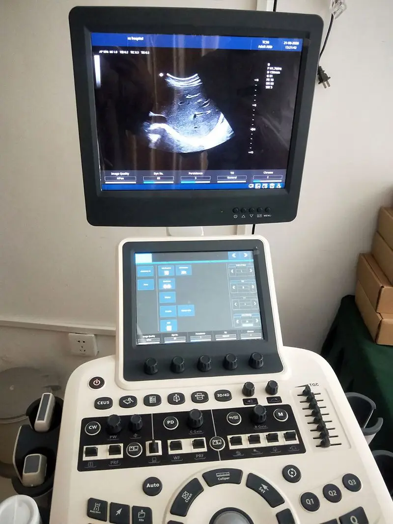 Медицинская ультразвуковая 3D 4D цветная допплеровская диагностическая система Medsinglong MSLCU46