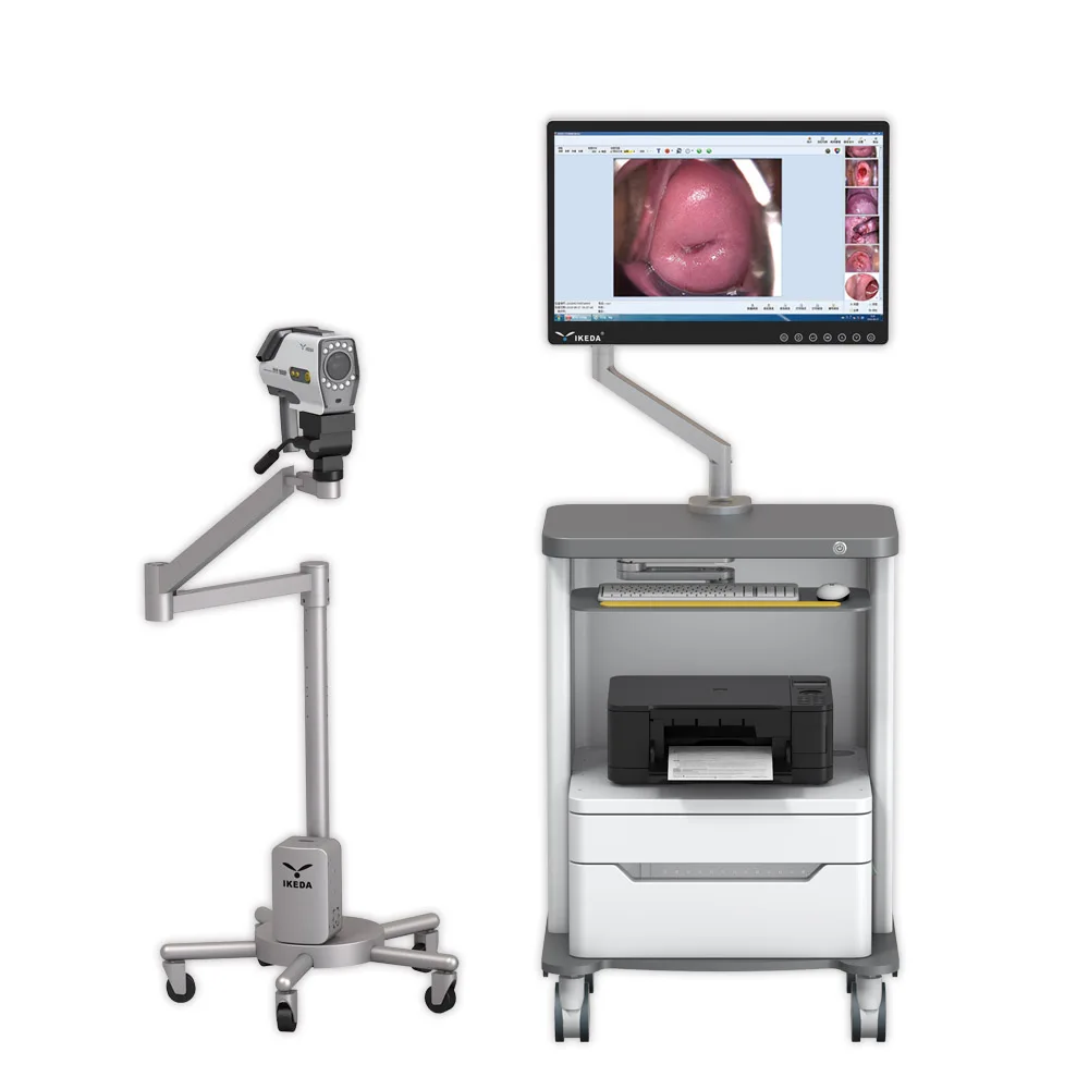 YKD-3001 Manufacturer Gynecology HD Video Digital Colposcope Imaging System Vagina Examination Colposcope