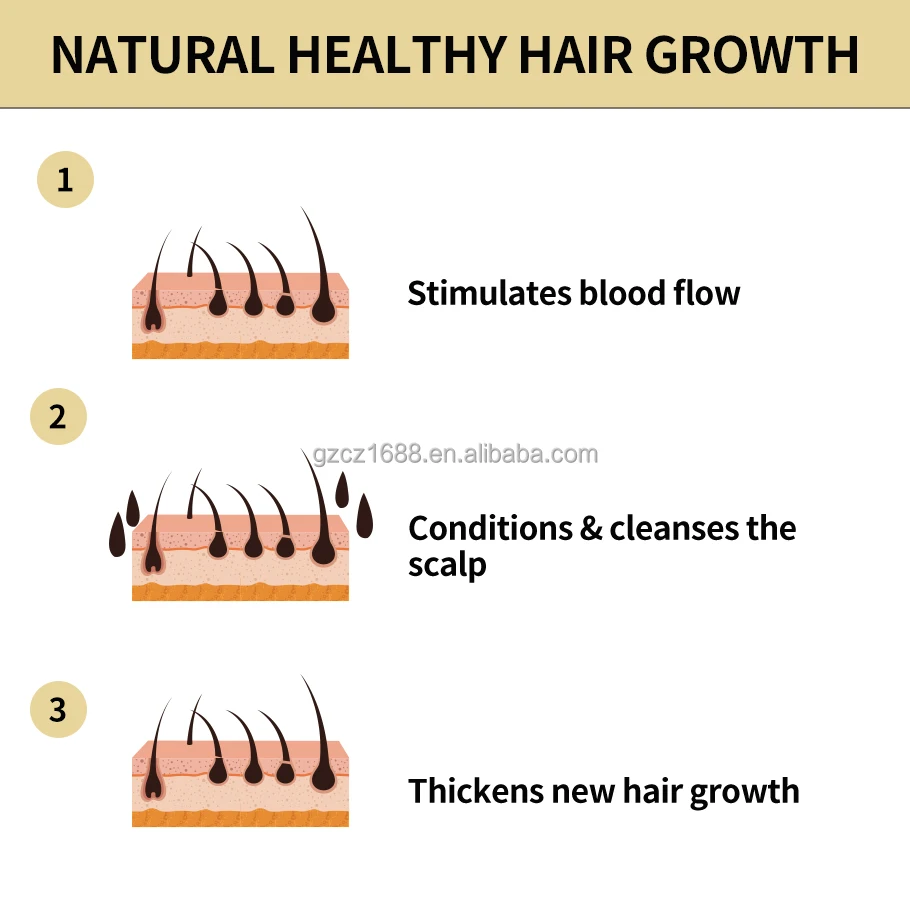Wholesale Organic Fast Hair Regrowth Oil Best Anti Loss Rosemary Natural Hair Growth Serum Oil Private Label